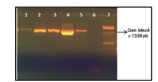 Detección por PCR del gen mecA en los
aislamientos de Staphylococcus aureus con resistencia a meticilina
(SARM) obtenidos del personal de salud
que rotan en las salas de cirugía y de recuperación.