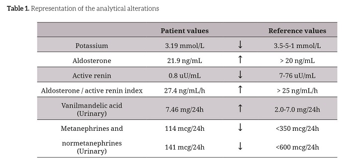  Representation of the analytical alterations