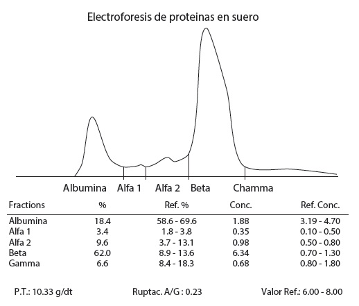 Proteinograma electroforético