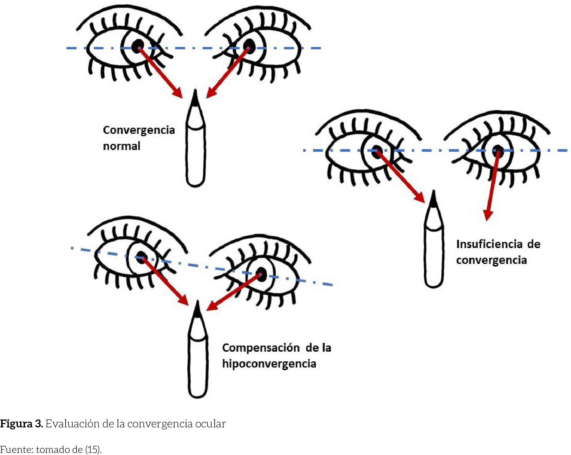 Evaluación de la convergencia ocular
